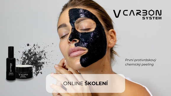 V-CARBON